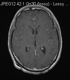 MRI Post - 1
